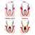 tratamientos-odontológicos-clínica-dental-Sonia-Jiménez-Plasencia