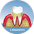 Periodontitis-en-Plasencia-dentista