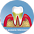 periodoncia-plasencia-clínica-dental