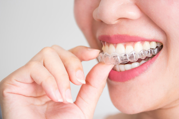 Ortodoncia invisible desventajas, ¿Cuánto cuesta la ortodoncia invisible?