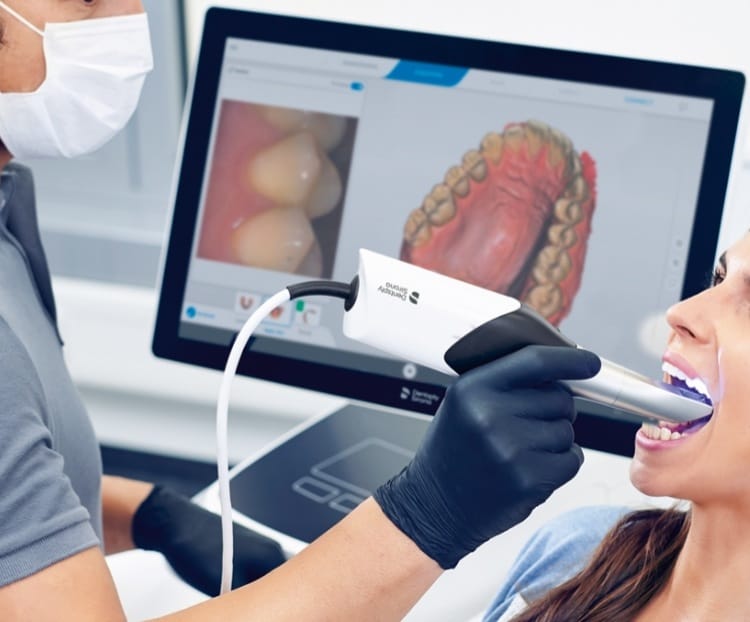 escaner intraoral -cirugía oral en Plasencia dentista en Plasencia