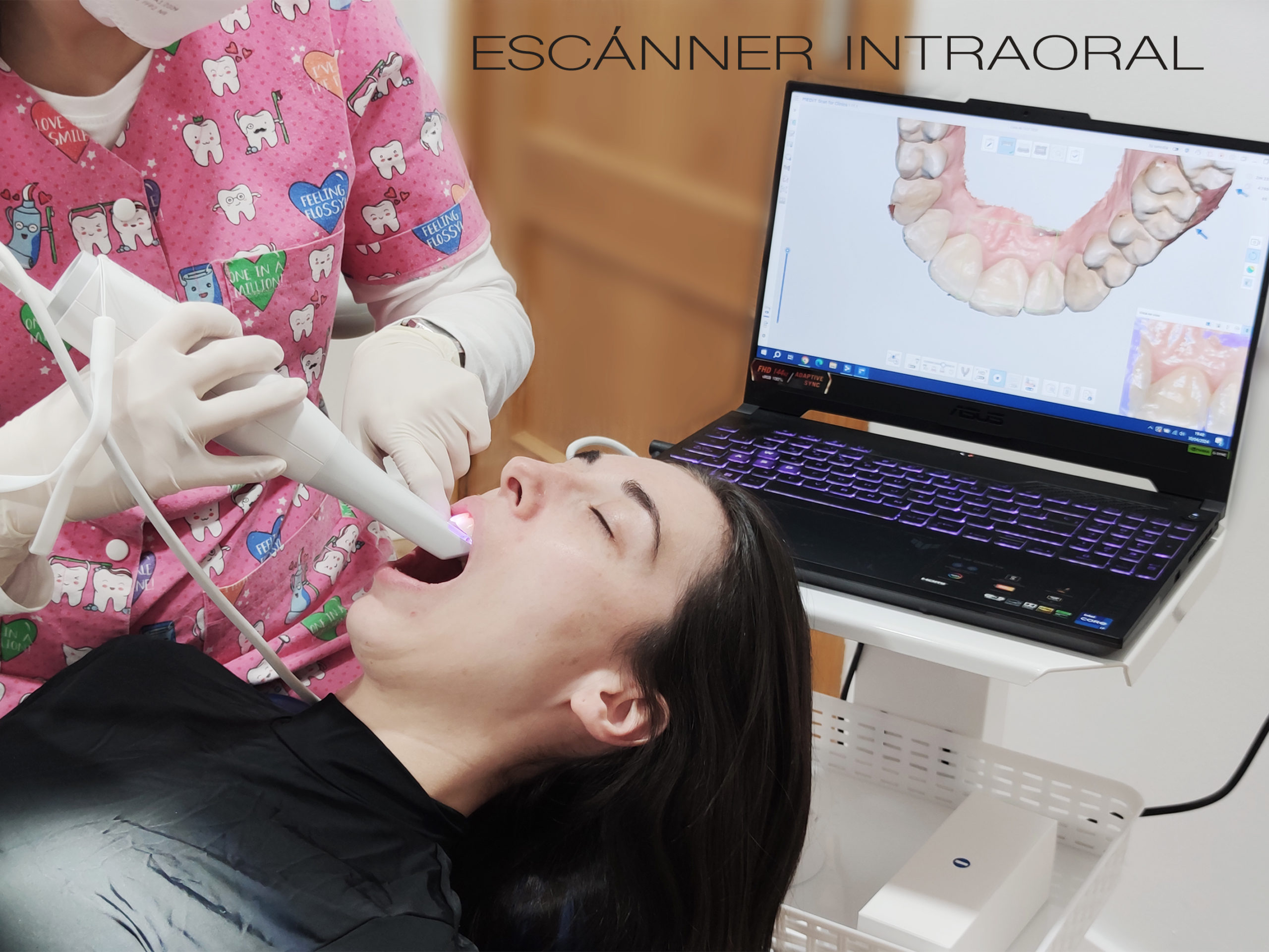 escáner intraoral, clinica dental plasencia
