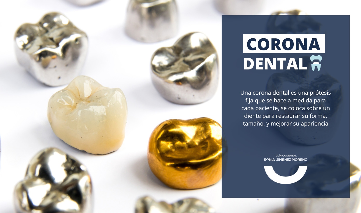 corona dental, qué es, ventajas y desventajas